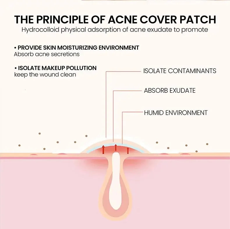 200pcs Facial Acne Pimple Repair Patch Cover