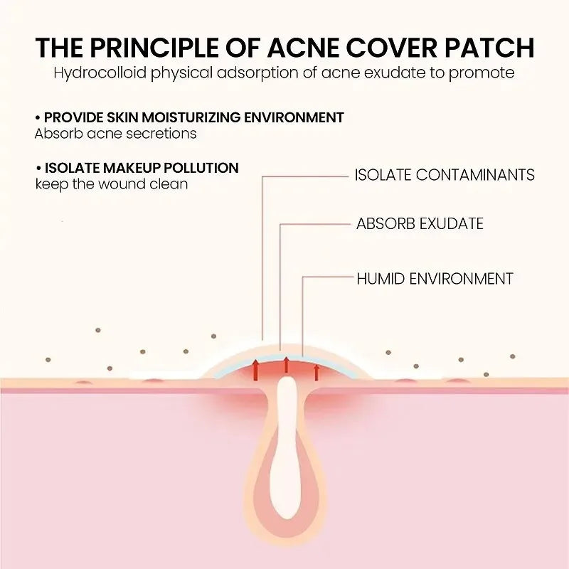 200pcs Facial Acne Pimple Repair Patch Cover