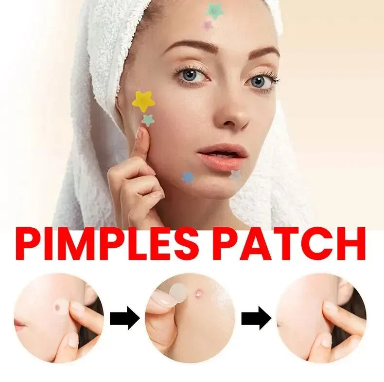 200pcs Facial Acne Pimple Repair Patch Cover